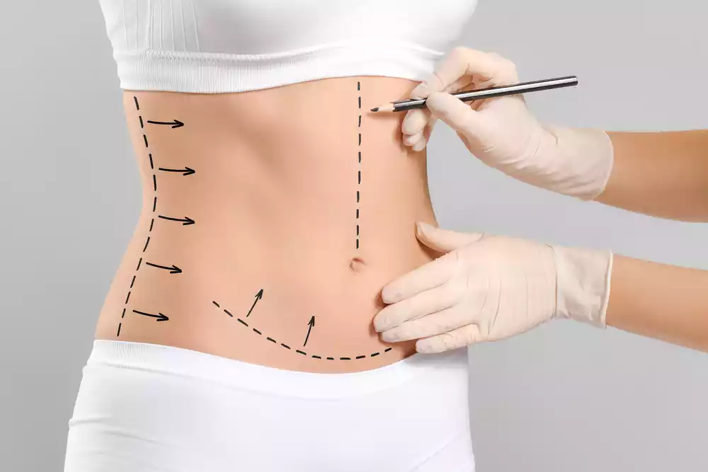 Key Factors in Successful Bariatric Surgery Post Operative Care