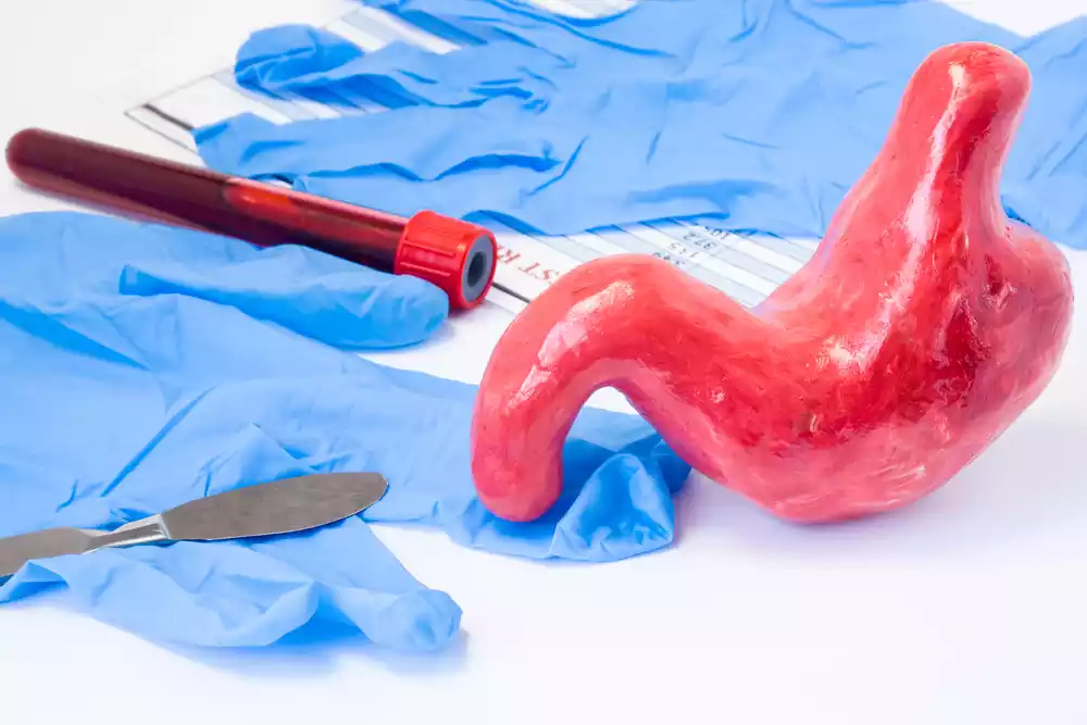 benefits of gastric sleeve