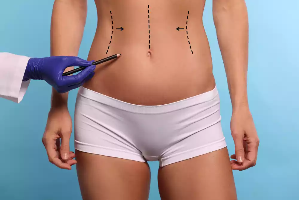 Know the Requirements for Bariatric Surgery
