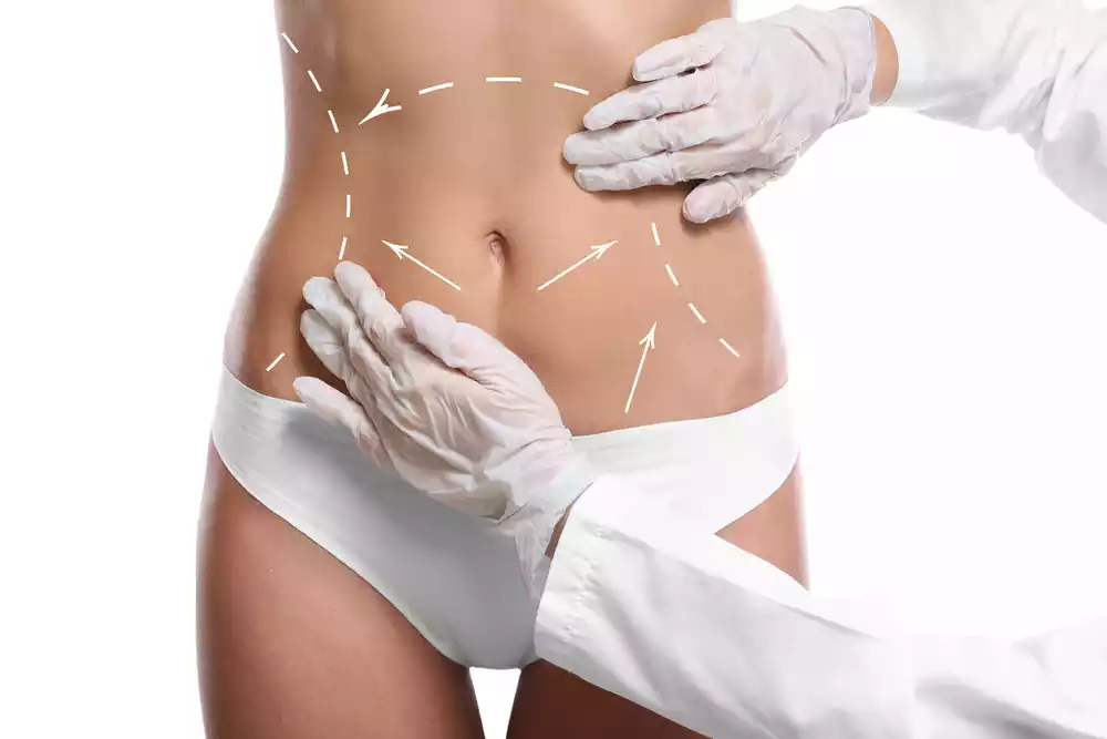 Lipo vs Gastric Bypass: Which One is Better?