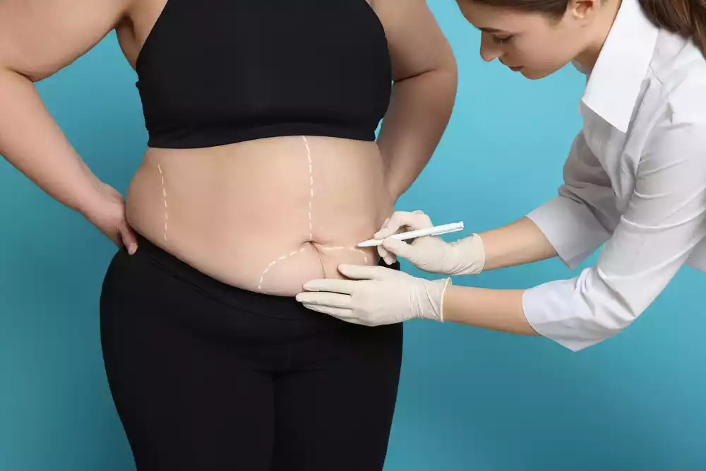 Understanding Gastric Sleeve Recovery Time