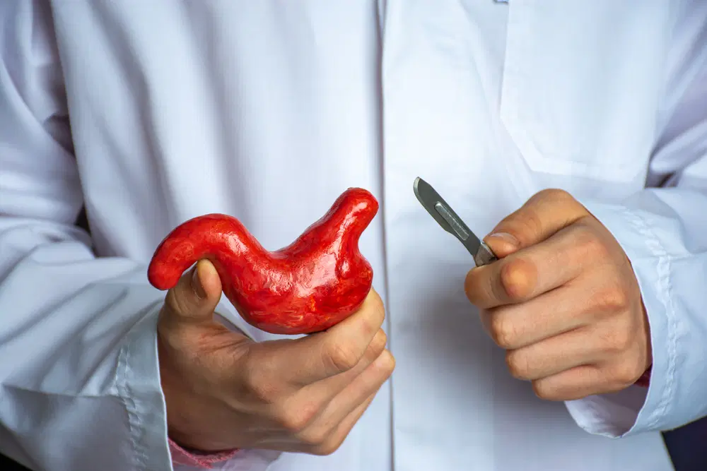 gastric bypass vs gastric sleeve weight loss